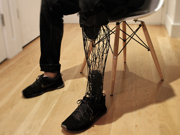 3d print Prosthetic Limbs